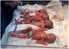 <b>伊拉克一女子顺产七胞胎 系该国首例</b>